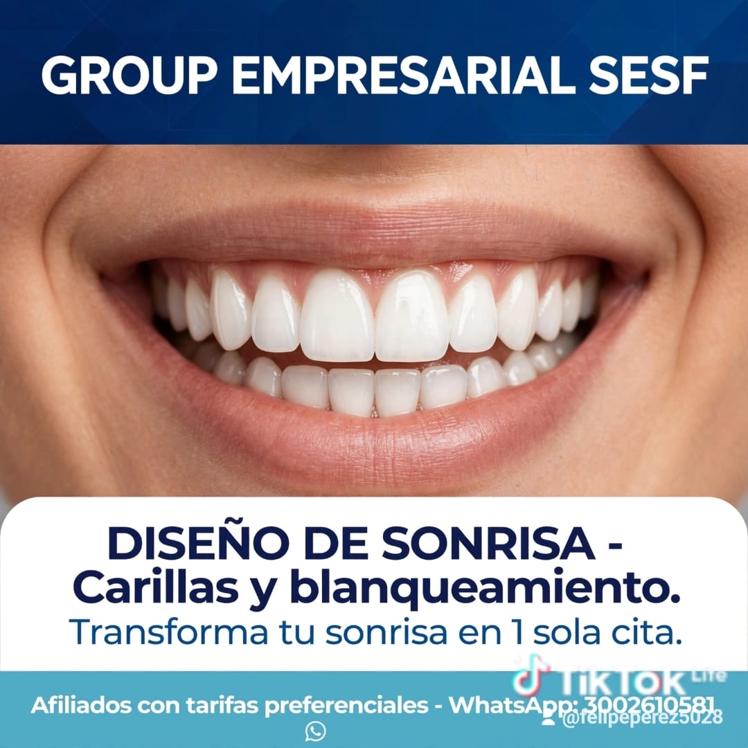 Diseño de sonrisa SESF, carillas y blanqueamiento